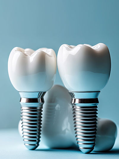 implants